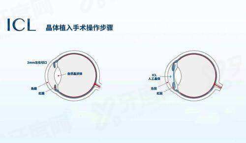 兰州华厦眼科医院挂号攻略：线上/电话/线下3种预约方式+医生介绍+价格表+地址公布