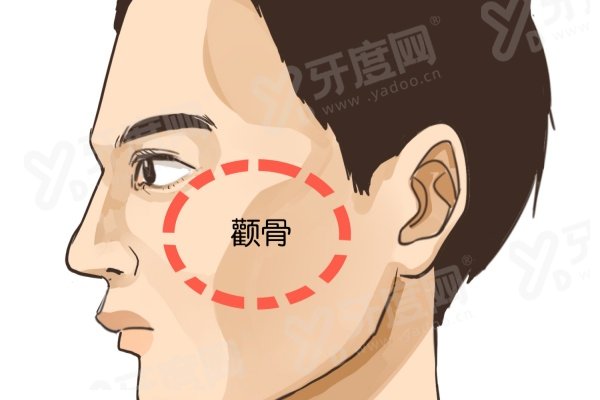 上海时光何晋龙手术贵吗？不贵！下颌角磨骨2.2W+/长曲线下颌角磨骨3W+