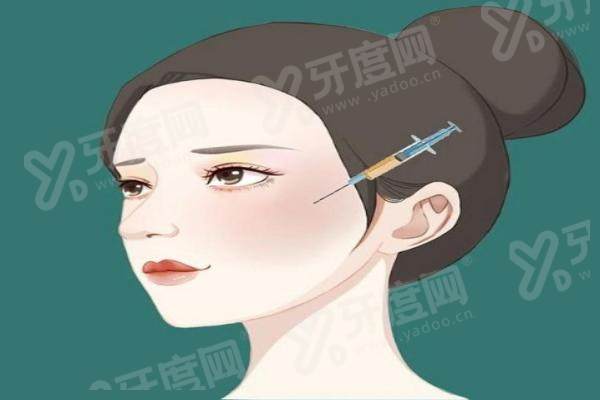 北京丽合医美肖英医生做注射多少钱？填充鼻唇沟1.8W+/填充太阳穴2.5W+/轮廓固定4W+