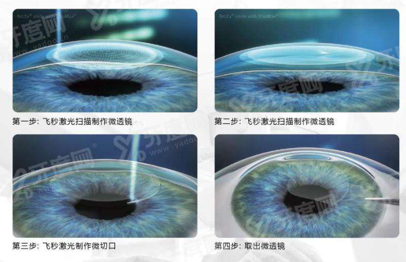 山西省眼科医院几点放号？一般是每天早上7点放号，附医院介绍+地址电话