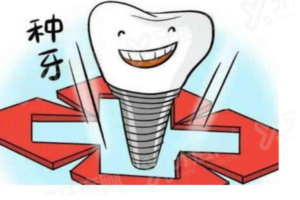 美格真植体价格表