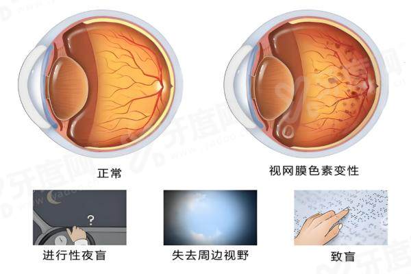 沈阳市铁西区十大眼科医院最新榜！爱尔眼科/普瑞眼科/明德眼科上榜，技术设备双在线