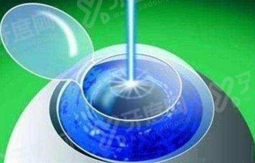 东莞市人民医院眼科在哪个院区?万江院区和普济院区,附预约指南+医生推荐