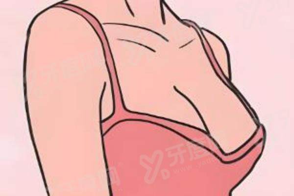 刘中国医生脂肪隆胸价格：自体脂肪隆胸2.8W+/纳米自体脂肪丰胸6.8W+