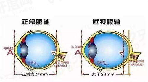 莆田华厦眼科医院靠谱吗?超靠谱!三级眼科资质+医生团队实力强,附价格表及地址详情