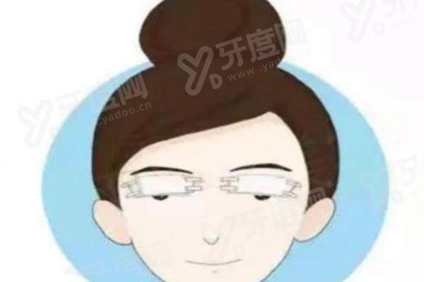 广州华美整形价格贵吗