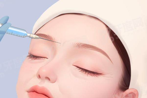 1763707286882271.jpg 眉弓注射1.jpg