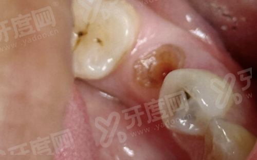 三、医院价格表