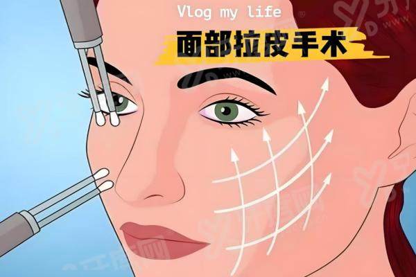 刘远程筋膜提升的价位：中下面部抗衰提升3.8W+/全脸无痕筋膜提升5W+，效果维持3-8年！