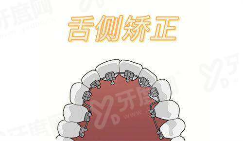 上海普陀区牙齿矫正医院排名前十名