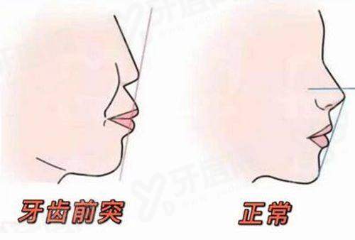 上海普陀区牙齿矫正哪家医院好？上海美奥/维乐/尤旦口腔这三家医院排名前三！ 