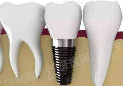 上海浦东川沙牙科排名前三名