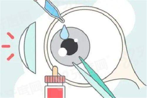 邢台眼科医院做近视手术可以随时做吗？不可以，需提前预约，挂屈光科室！