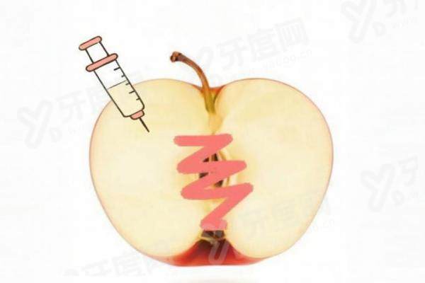 西京医院私密整形价格多少？私密整形7k-1.6w左右，王中琨医生靠谱