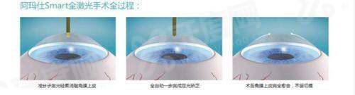  杭州爱尔眼科医院营业时间详解+预约挂号指南+地址导航