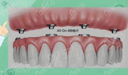 四、尤旦口腔地址电话