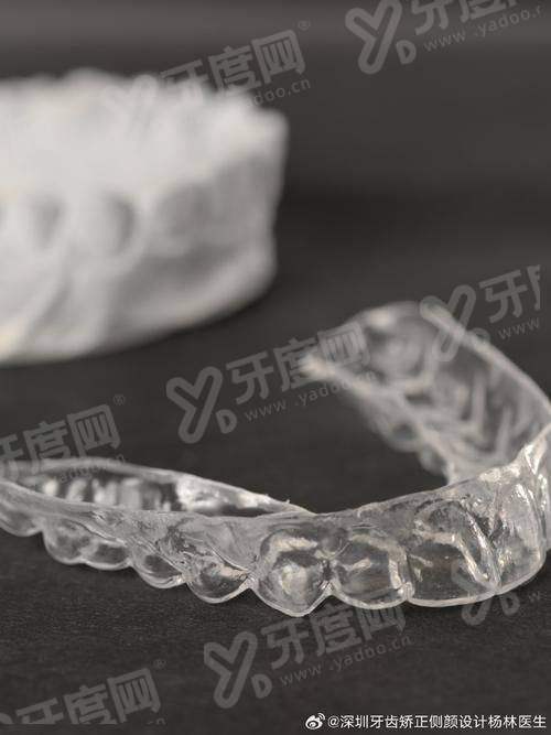 美国奥美科跟3m哪个好？从背景/优点/价格看奥美科跟3m自锁托槽各有优势