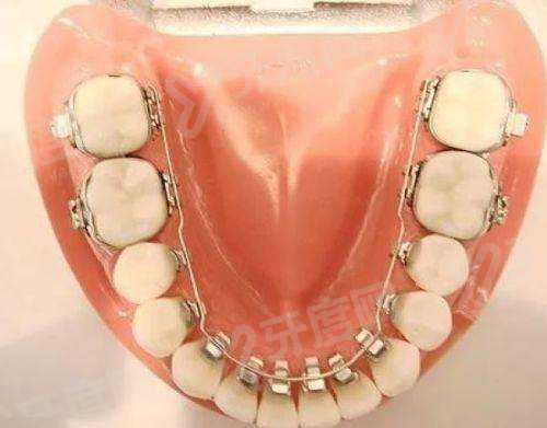 四、郑州白皮书口腔医院地址及在案例