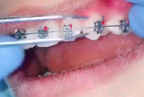 广州中家医家庭口腔是公立的吗？是正规私立口腔医院，种植矫正技术好价格不贵，附地址 