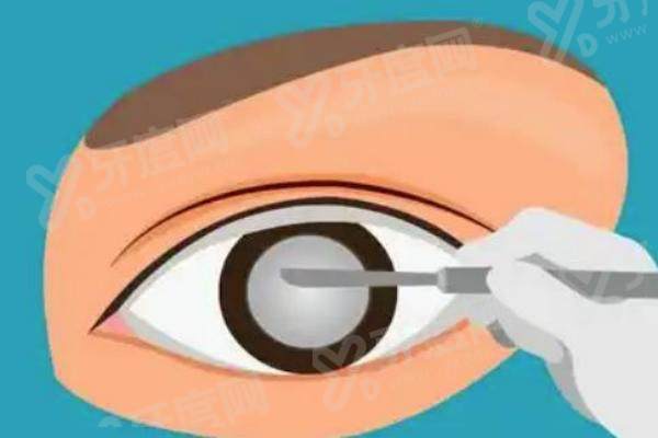 郑大一附院眼科咨询热线