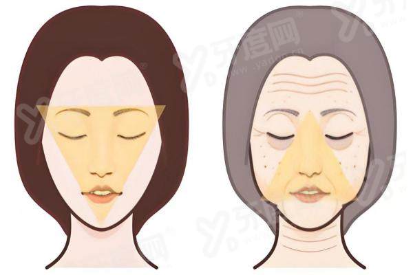 光微提升多少钱一次？项目1.5W+/2.5W+/3W+/3.8W+，效果能保持5 - 7年！