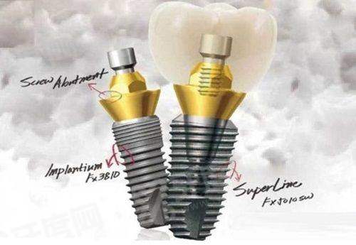 上海长宁区口腔医院哪家好？上海美奥口腔/维乐/尤旦口腔上榜前三名！ 