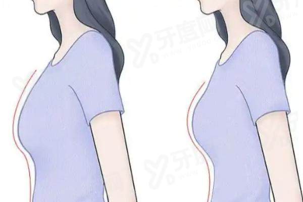 八大处李发成脂肪填充多少钱？自体脂肪丰胸14800元起，自体脂肪丰额头2728元起，自体脂肪丰面颊8824元起 