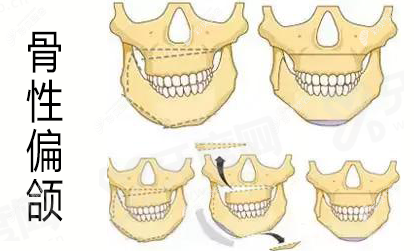 女性私密整形手术的费用：阴唇整形1w/阴道紧缩2W元起，效果不错！