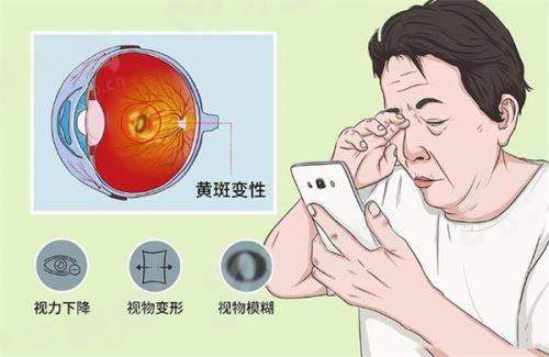 二、深圳陈韶红医生做屈光手术怎么样？