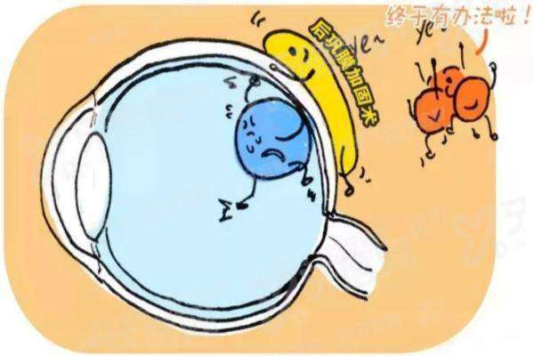 在北京熙仁眼科医院做的后巩膜加固术怎么样？封康光纤导航技术靠谱，微创25分钟当天睁眼|附价格表