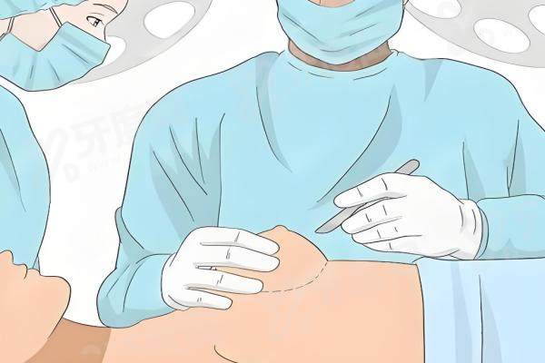 重庆哪家医院做缩胸手术好？重庆华美/重庆美莱/重庆艺星上榜前三！