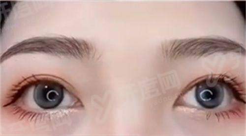 二、徐永丰医生做鼻子怎么样？