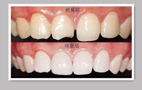 二、上海薇琳伯曼口腔医院价格表