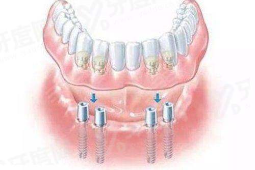 上海奉贤区牙科医院排名前十，前三甲是上海尤旦/美乐奉浦医院口腔科