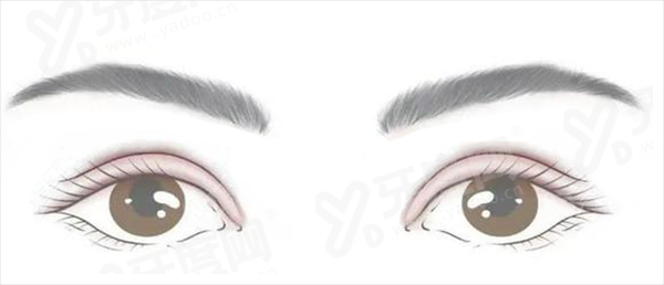 王恒双眼皮修复技术怎么样