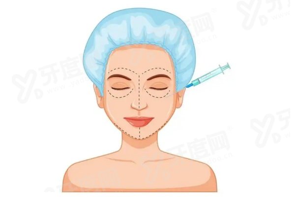 上海朱维玲双眼皮价格表：埋线3000元起/韩式三点5000元起/全切8000元起