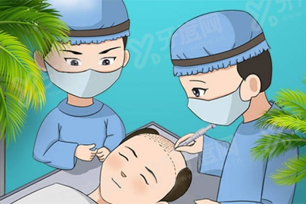 西安雍禾植发价格一览表：植发8k+毛囊单位 1w+毛囊单位 2w+