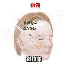 余东文取生长因子怎么样？多模态影像定位+分层剥离+修复缝合技术，恢复原生形态