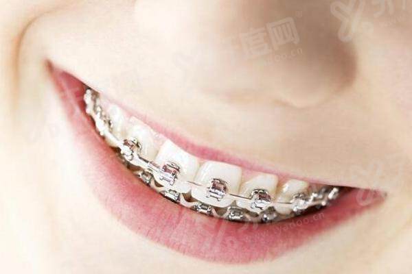 天津中百口腔医院价目表：种植牙1680元起，牙齿矫正6000元起，性价比超高！ 