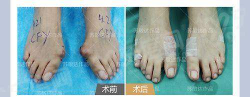 万友望医生擅长什么项目？擅长脂肪丰胸+吸脂塑形，资深背景实力强！