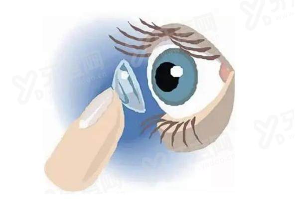 深圳刘红山医生做白内障多少钱？白内障手术7000元起、高端晶体4.8万元起 