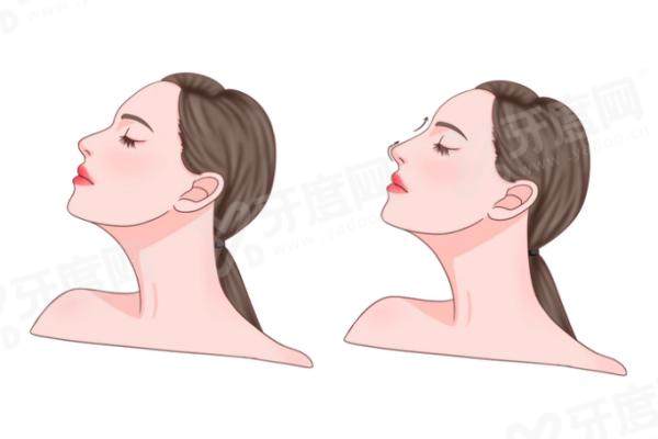 济南韩氏整形美容医院隆鼻哪个医生好？郭广科 / 王召东院长实力领衔！附详细隆鼻价格表，透明无套路！