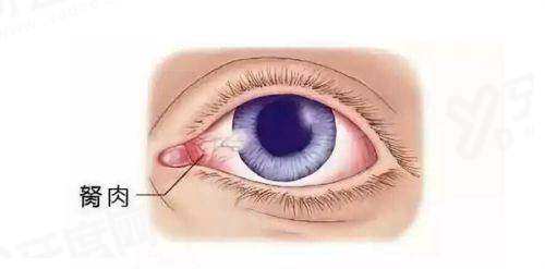 宜昌华厦眼科医院院长是谁？20年经验的李建国医生！预约30秒搞定+位置就在夷陵广场