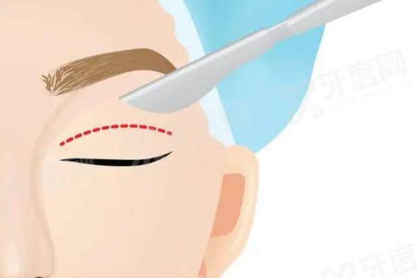 北京谭章梅双眼皮修复案例：针对性解决各类“眼难题”，显微镜操作超精细！价格8k起！