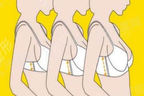 1766029439492666.jpg 隆胸3(1).jpg