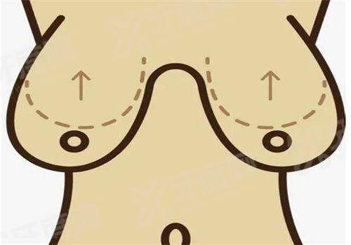 邓晟华面部吸脂技术怎么样？多案例见证精湛技艺，价格8000元起合理超值得！