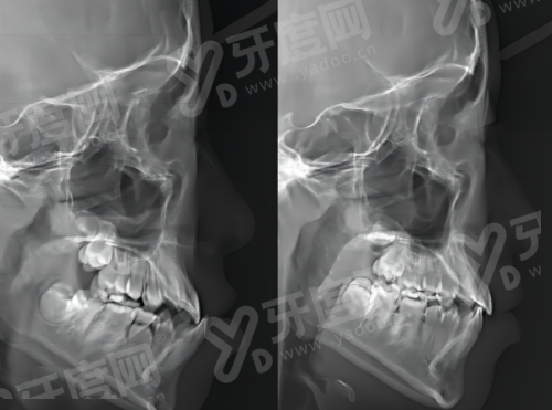 许昌植得口腔医院种植牙怎么样？当天种牙当天用，价格1980元起，市区中心超好找！