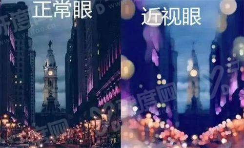 三、 西安存济眼科医院近视手术：医生团队的“学术”，让患者用到“前列技术”