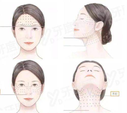 英伦大提升能维持多久？维持8~12个月！效果好改善松弛，价格8000起