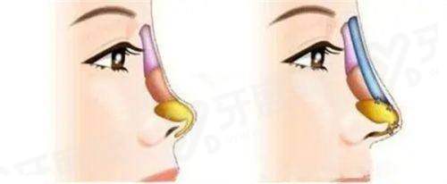 蒙石南拉皮技术好吗？技术靠谱口碑好，风险低价格合理，抗衰性价比之选！